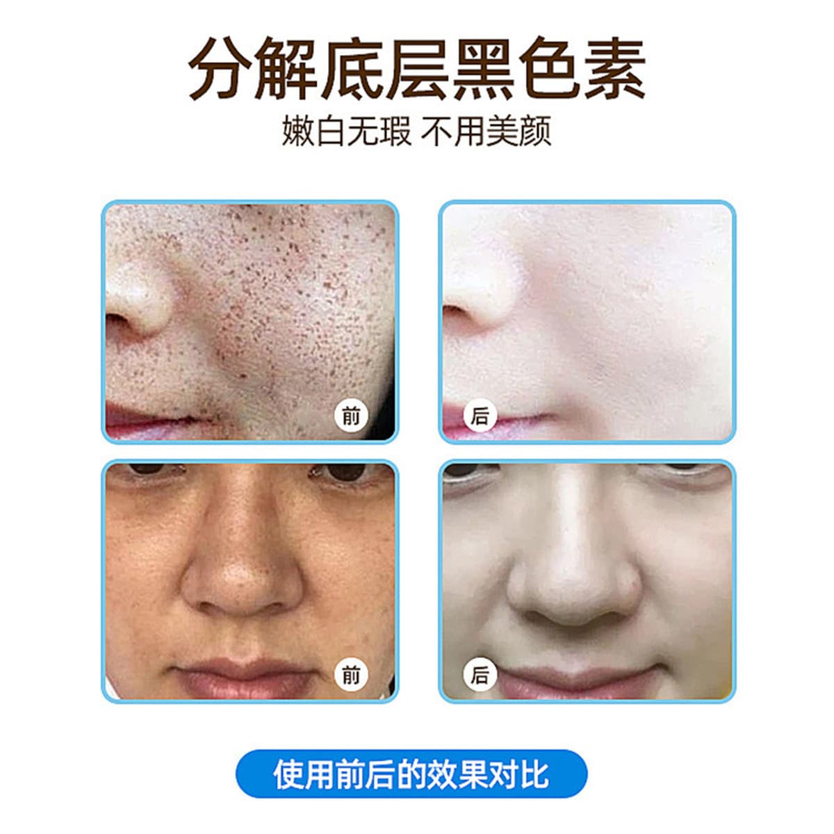 Производители оптом растворяющие пятно жидкий цвет жидкий слив веснушки проповедь растворимый пигмент хлоазма салон красоты